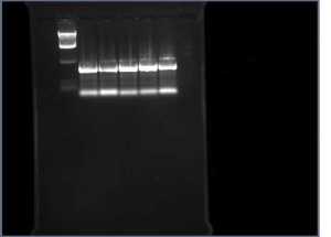 Figure 1: N terminal PCR products ran at 100 volts through 1% agarose gel for 30 minutes with an anomaly of 2 bands